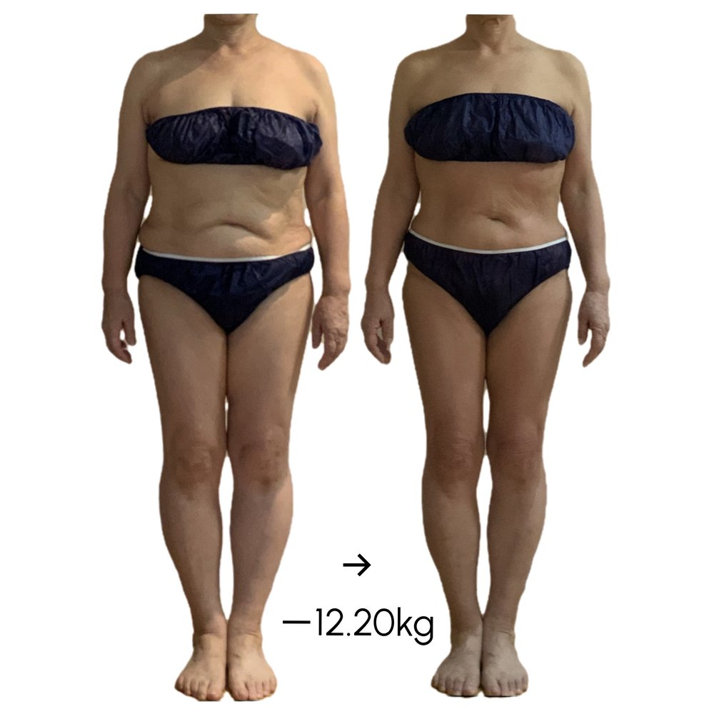 ビフォーアフター -12.2kg