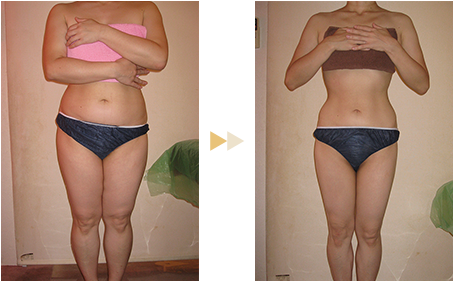 痩身コース ビフォーアフター
