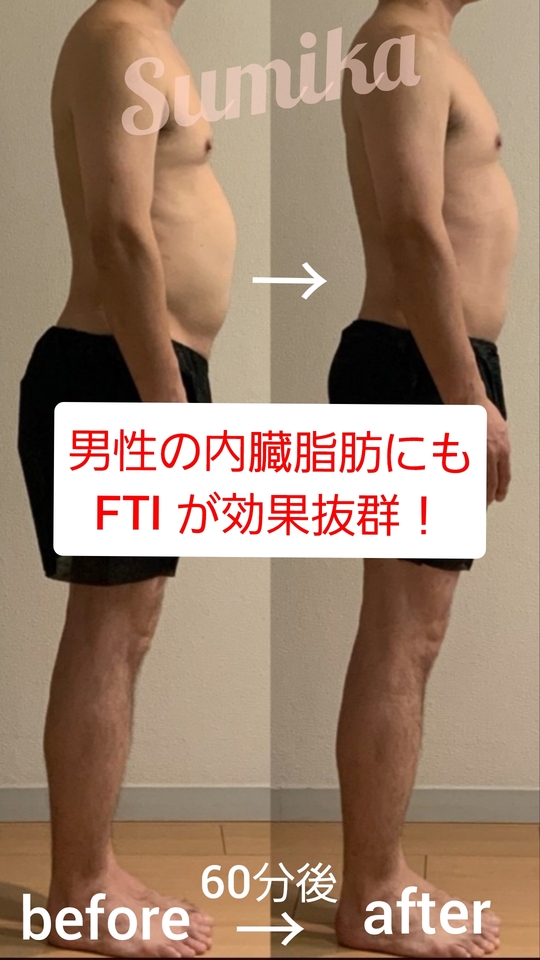 男性のぽっこりお腹にはFTIマシーン！