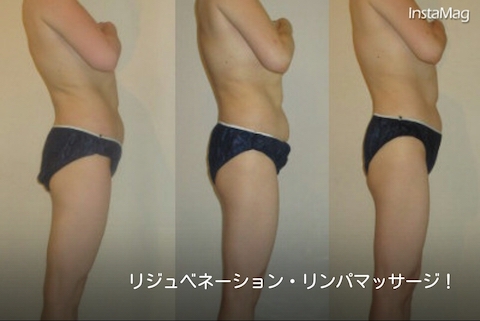 見た目年齢の変化にびっくり！