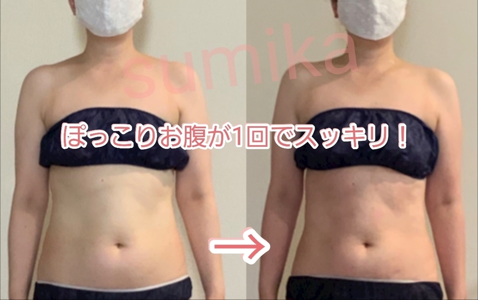 腸の位置セルフチェック！