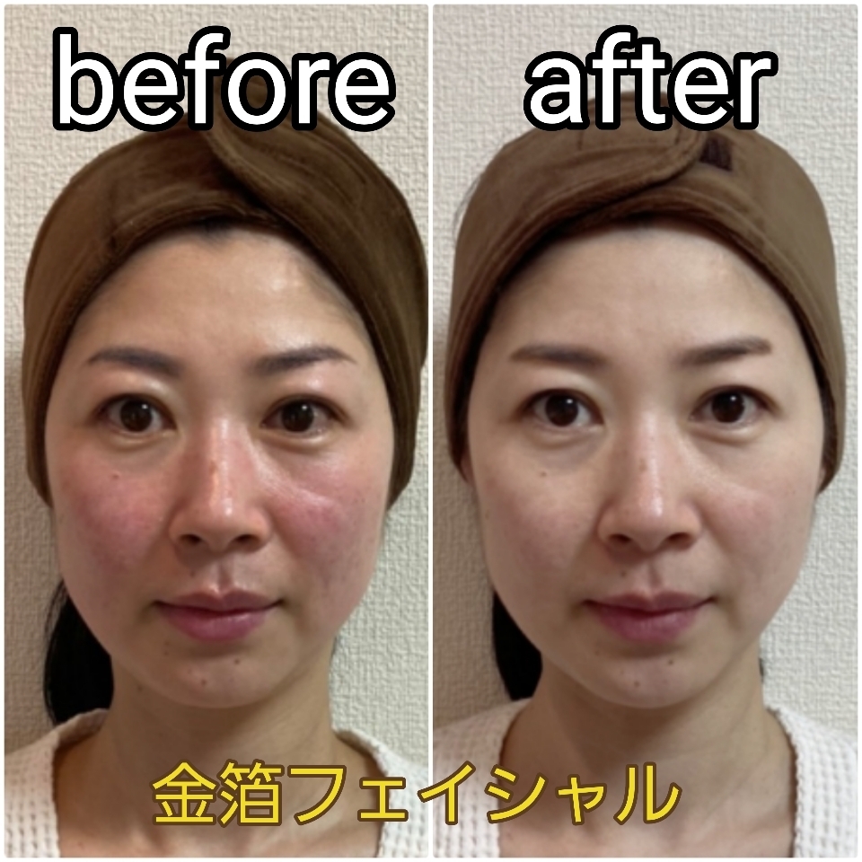 見た目年齢おいくつですか？