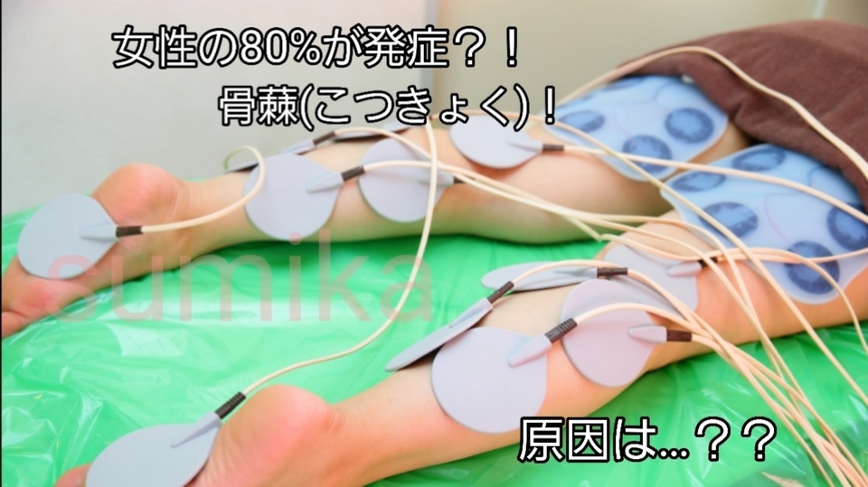 骨棘(こつきょく)ご存知ですか？？