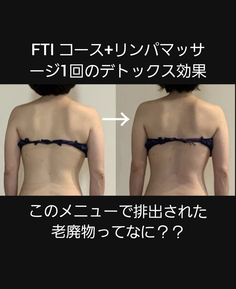老廃物の正体って？？