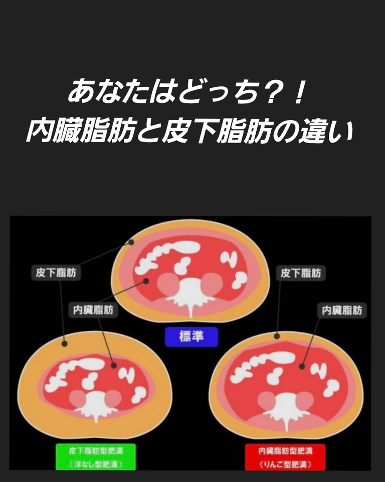あなたはどっち？！　内臓脂肪と皮下脂肪の違い！